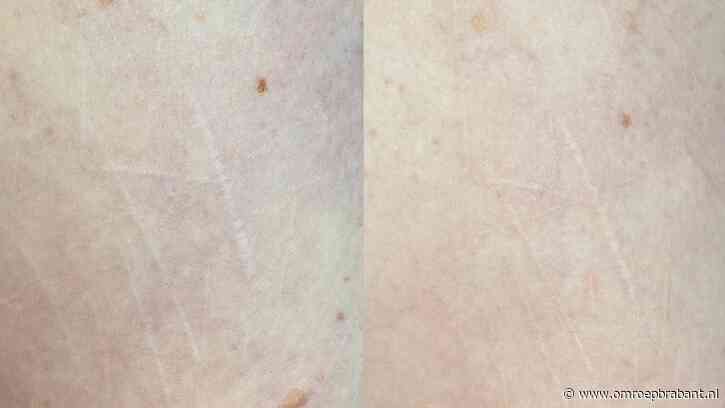 Roos en Margonda gebruiken permanente make-up: ‘Kon mezelf weer herkennen'