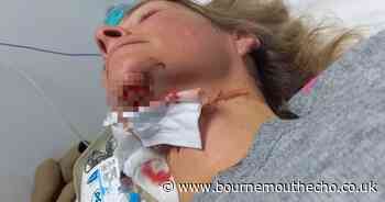 Woman's head smashed into her car after hit-and-run driver crash