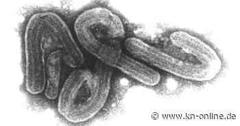 Marburg-Virus: Ruanda findet Ursprung des Ausbruchs