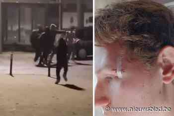 Beelden tonen hoe Ryan (18) en vrienden plots aangevallen worden op straat: “We hadden geen schijn van kans”