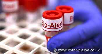 Doctor lists four main symptoms of mpox as first case of potentially deadly strain detected in UK