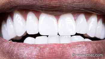 Calculus Bridge: What It Is, How to Prevent One and How It Affects Your Teeth