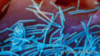 Flu and RSV activity in Ontario expected to increase, COVID-19 to decrease: report