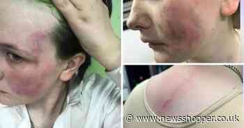 'Angry' mum ‘wants justice’ for daughter, 14, attacked in Belvedere park