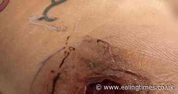 Gym fanatic warns against ‘quick fixes’ after brush with death