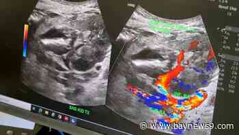 TGH surgeon first to use new donor pancreas preservation technology