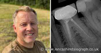 Man left in agony after botched root canal wins compensation