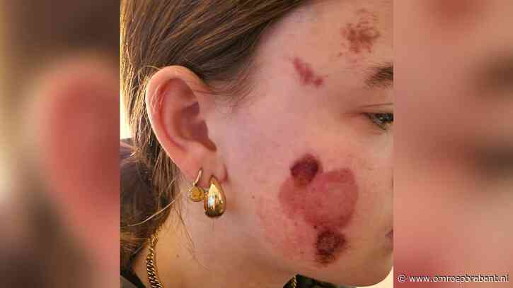 Bestuurder witte Audi gezocht, laat meisje (15) achter na aanrijding