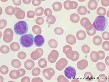 Leucemia linfatica cronica, nuove speranze dalla ricerca: le terapie per contrastare la patologia