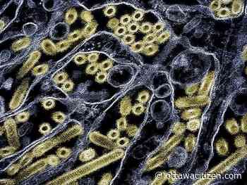 Hospitals testing for H5N1 avian flu as virus season ramps up