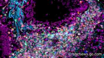 Scientists map out the human body one cell at a time