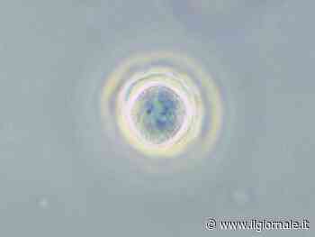 Cheratite da Acanthamoeba, primo farmaco salva cornea: di cosa si tratta