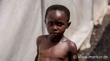 WHO: Mpox-Ausbruch weiter gesundheitliche Notlage