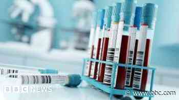 Thousands tested for HIV and hepatitis in Bristol