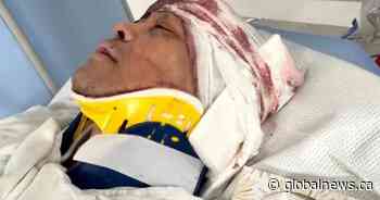 A Good Samaritan stopped to help victims of B.C. HWY 1 crash. But now he needs help