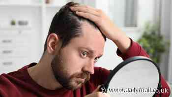 Scientists reveal the common habit that could make you BALD