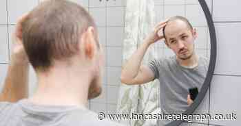 Is Christmas turning you bald? Scientists say this festive habit causes baldness