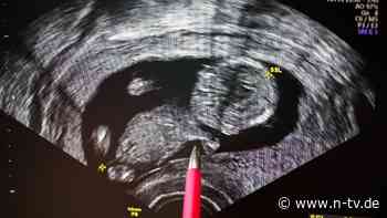 Union lehnt Gesetzesvorschlag ab: Große Mehrheit unterstützt Legalisierung von Abtreibungen