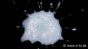 Körpersaft mit Imageproblemen: Schleim ist mehr als Schmierstoff für den Körper