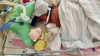 „Ich fühlte mich so hilflos“: Mutter spricht über ihre Frühgeburt