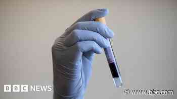 Police drop drug-testing probe over lack of funds