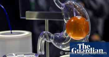 Experts create controllable gastric balloon to aid weight loss