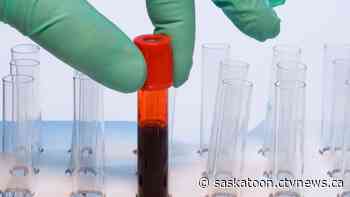 Saskatchewan maintains dismal status as leader in spread of HIV, with no provincial strategy in place