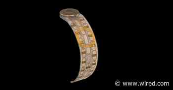 Muscle Implants Could Allow Mind-Controlled Prosthetics—No Brain Surgery Required