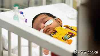 Most RSV infections are in babies less than 1 year old. But protection remains out of reach for many