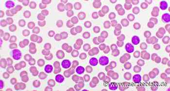 Blinatumomab verbessert Ergebnisse der Chemotherapie bei B-Zell-ALL im Kindesalter