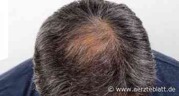 Haarverlust: Experten beurteilen orale Low-Dose-Therapie mit Minoxidil