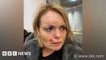 Injured woman speaks of terror in Star Flyer crash