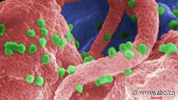 Sask. HIV rates are worst in Canada, recent stats show