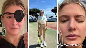 Tennis-Spielerin böse am Auge verletzt