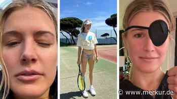 Tennis-Schönheit muss nach Augenverletzung ins Krankenhaus