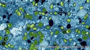Schulschließung wegen Mpox - Was bedeutet das?