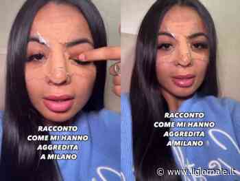 Onlyfanser aggredita a Milano da due ragazzini: presa a calci per aver negato un selfie