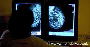 Concern over reduction in cancer screening in the UK