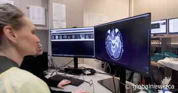 Epilepsy patient becomes nurse at the same B.C. hospital unit that changed her life