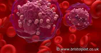 Six 'early' blood cancer red flags people 'should not ignore' and see a doctor