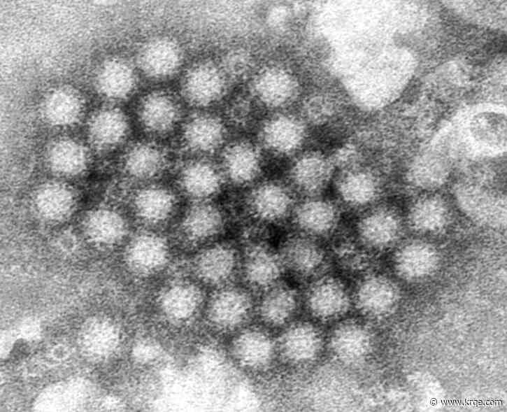 CDC: Norovirus cases on the rise in New Mexico