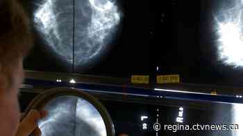 Sask. women between 47 and 49 now eligible for breast cancer screening