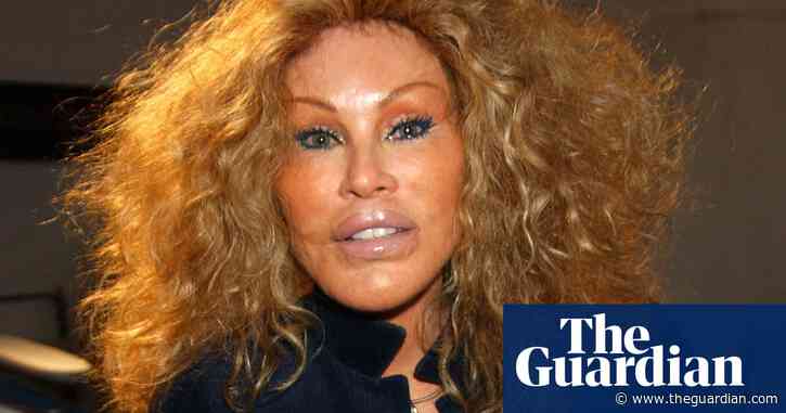 Jocelyne Wildenstein, socialite known for extreme cat-like plastic surgery, dies at 84