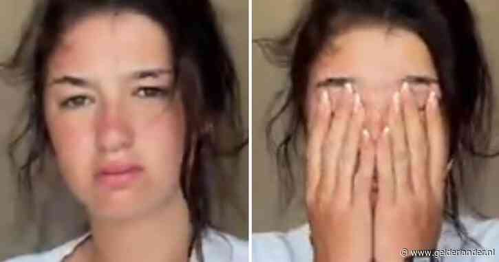 ‘Perfecte’ influencer gaat tegen de stroom in en toont brak hoofd op 1 januari: in één dag 3 miljoen views