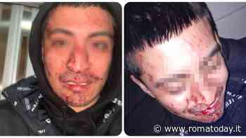 Coppia gay pestata a Capodanno, Roma si ribella all'omofobia: "Tolleranza zero"