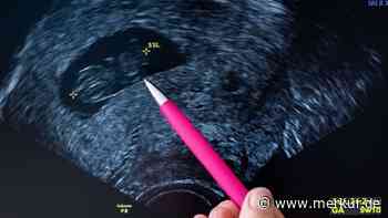 „Schutzlücke für schwangere Frauen endlich geschlossen“: Mutterschutz soll auch nach Fehlgeburten greifen