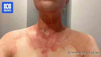 Inquiry to probe health impacts from 'rotten egg' odour