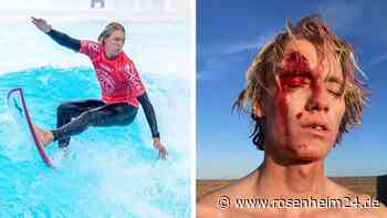 „Hatte richtig Glück“: Deutscher Olympia-Star schockt mit Horror-Fotos nach Sturz