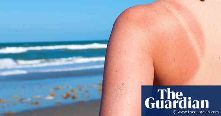 Burning is risky – so why are tan lines having their time in the sun on social media?
