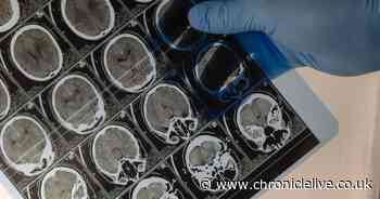 Teenagers told to consider dementia risk after 'unhealthy childhood' linked to brain changes